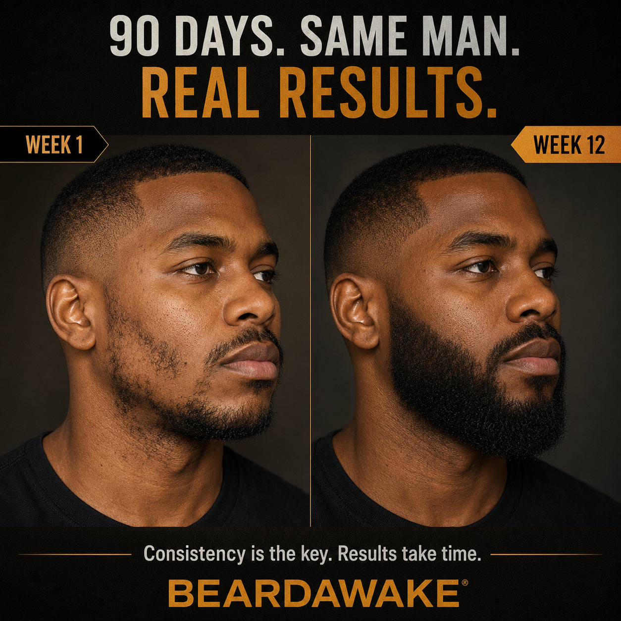 BeardAwake 90 day before and after - denser, connected beard by week 12