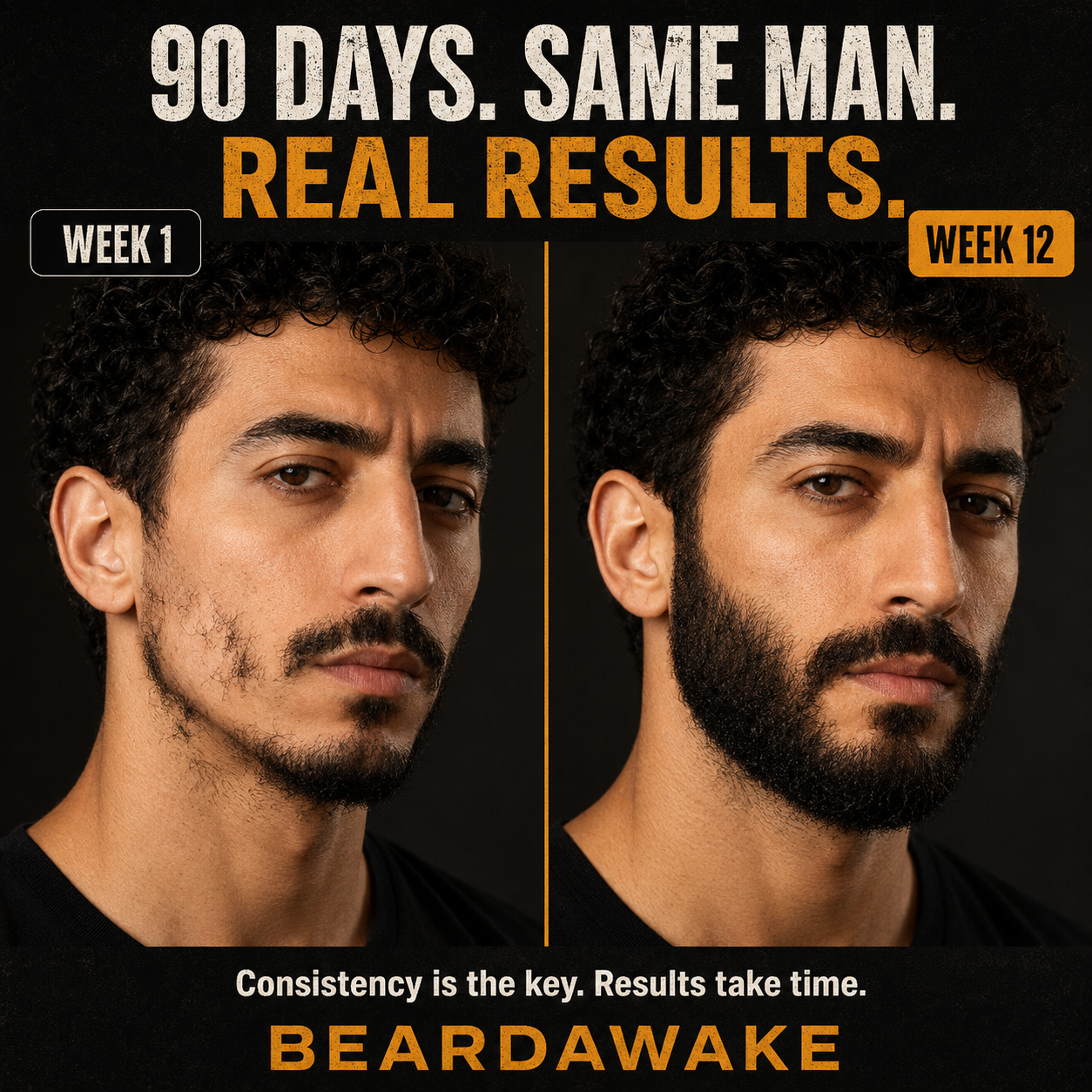 BeardAwake customer result showing improved beard coverage from week 1 to week 12